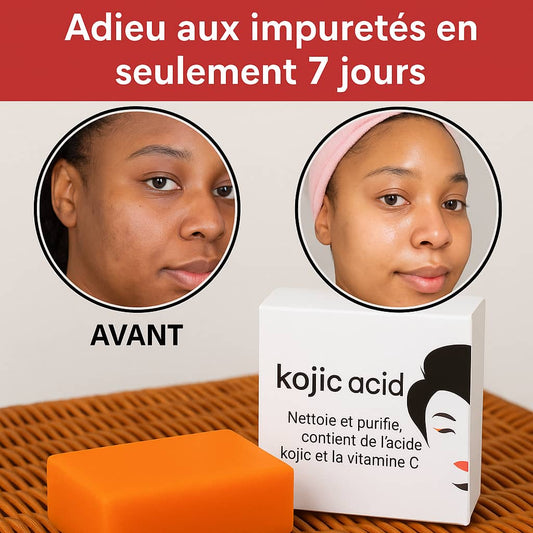 Savon Kojie San : Éclat Naturel, Peau Nette, Fraîche & Éclatante